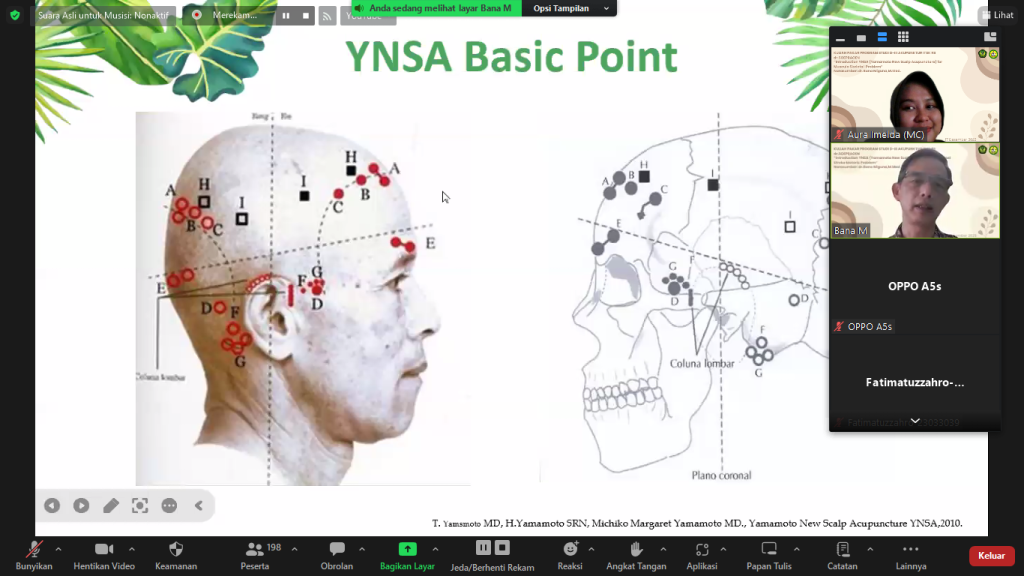 Kuliah Pakar “Introduction Yamamoto New Scalp Acupuncture For Post Musculoskeletal Problem” Menarik Perhatian Ratusan Peserta