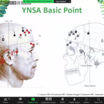 Kuliah Pakar “Introduction Yamamoto New Scalp Acupuncture For Post Musculoskeletal Problem” Menarik Perhatia